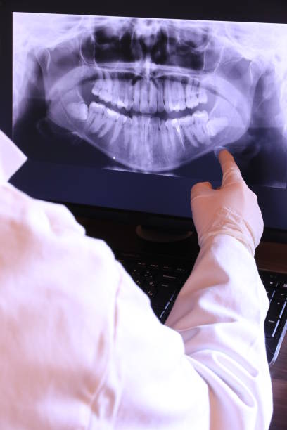 Best Emergency Wisdom Teeth Removal in Shavertown, PA