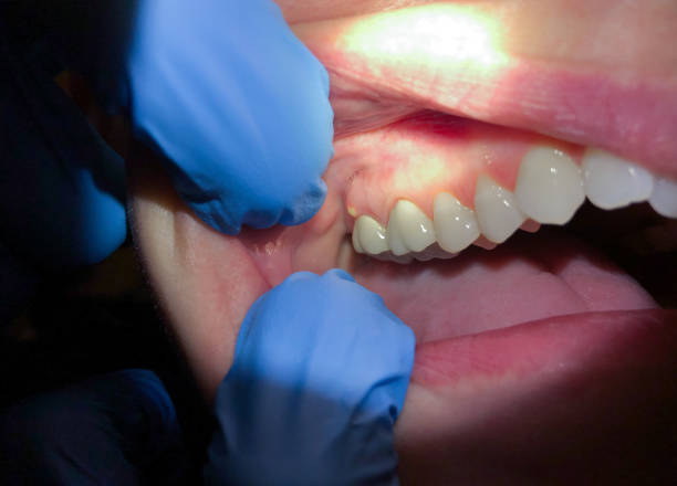 Best Weekend Emergency Dentist in Shavertown, PA