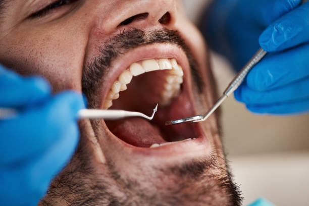 Best Walk-In Emergency Dentist in Shavertown, PA