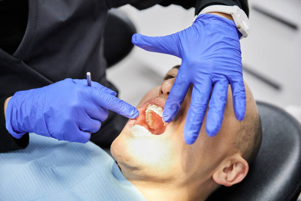 Best Emergency Tooth Extraction in Shavertown, PA