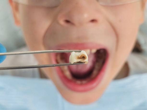 Best Emergency Orthodontic Repairs in Shavertown, PA