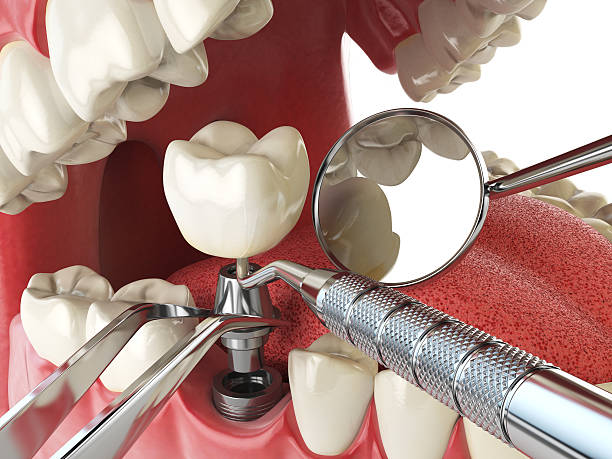 Best Emergency Broken Tooth Repair in Shavertown, PA